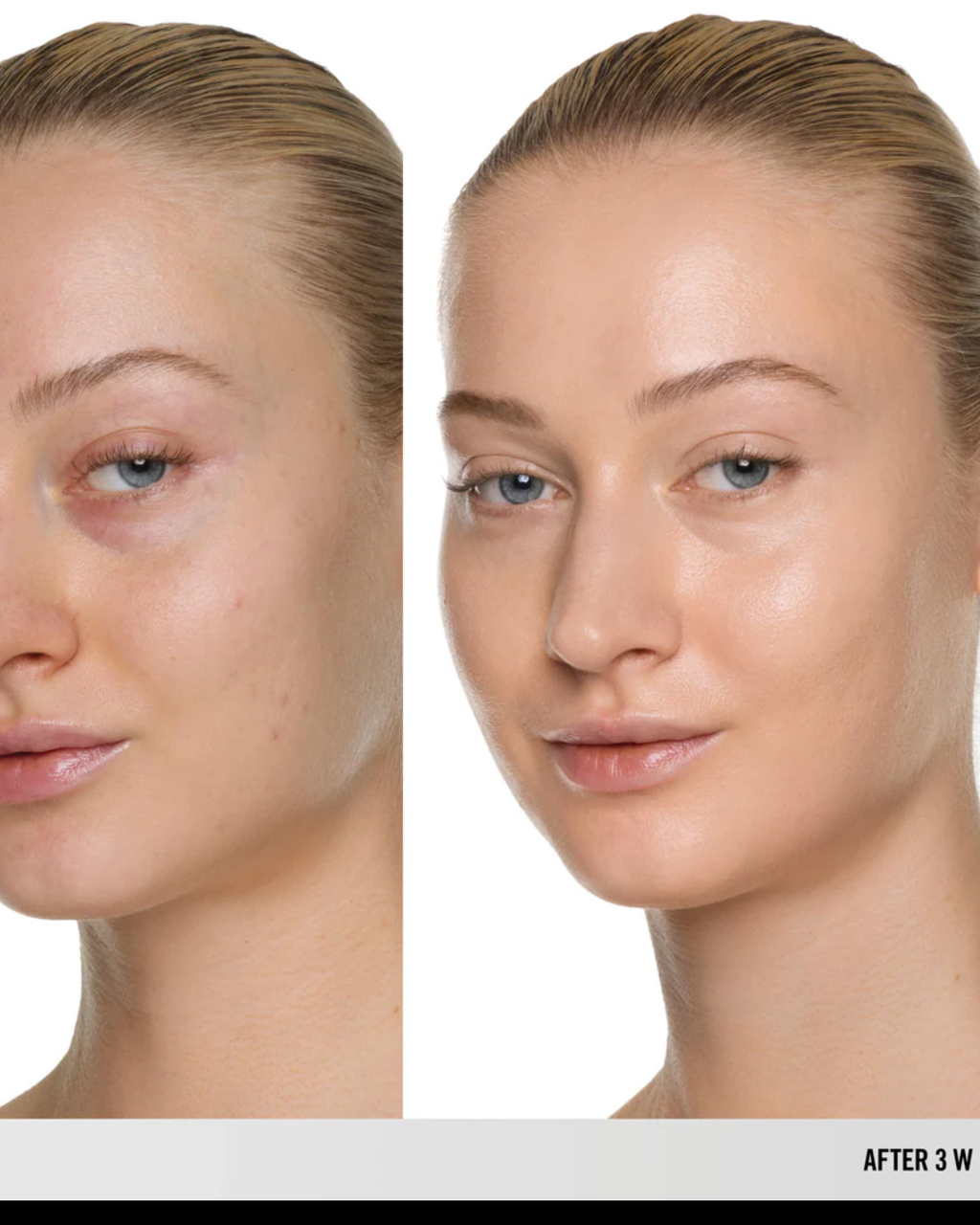By mario | surrealskin foundation| 3w